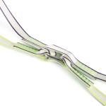 des boutonnières cousues pour le fractionnement de secours